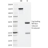 SDS-PAGE - Anti-NCAM1 Antibody [123A8] (A249476) - Antibodies.com