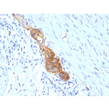 Immunohistochemistry - Anti-NCAM1 Antibody [SPM489] (A249476) - Antibodies.com