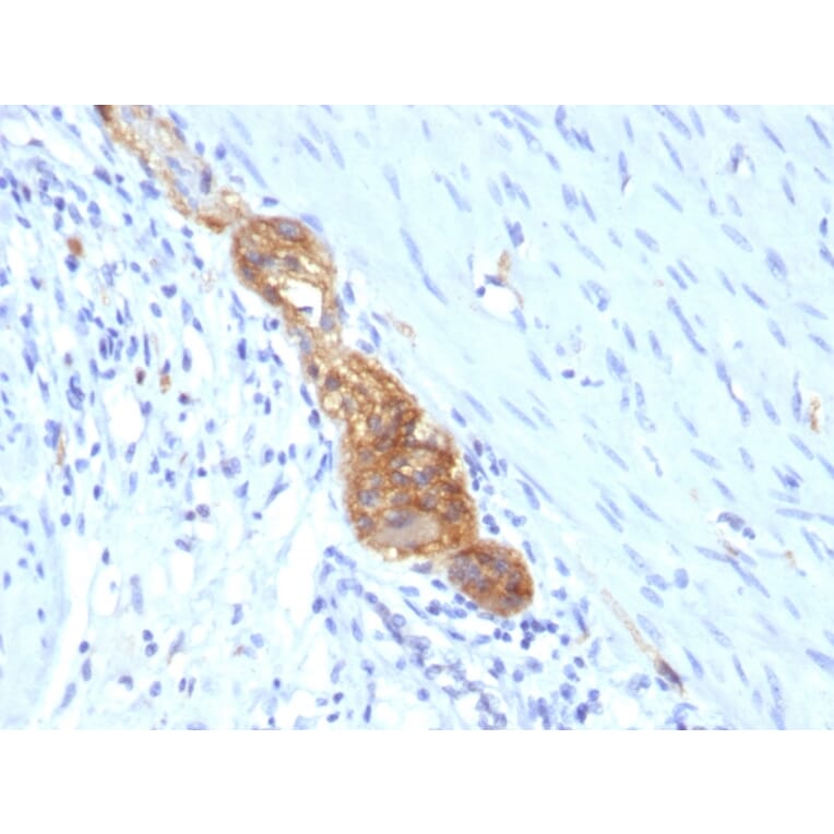 Immunohistochemistry - Anti-NCAM1 Antibody [SPM489] (A249476) - Antibodies.com