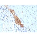 Immunohistochemistry - Anti-NCAM1 Antibody [SPM489] (A249476) - Antibodies.com