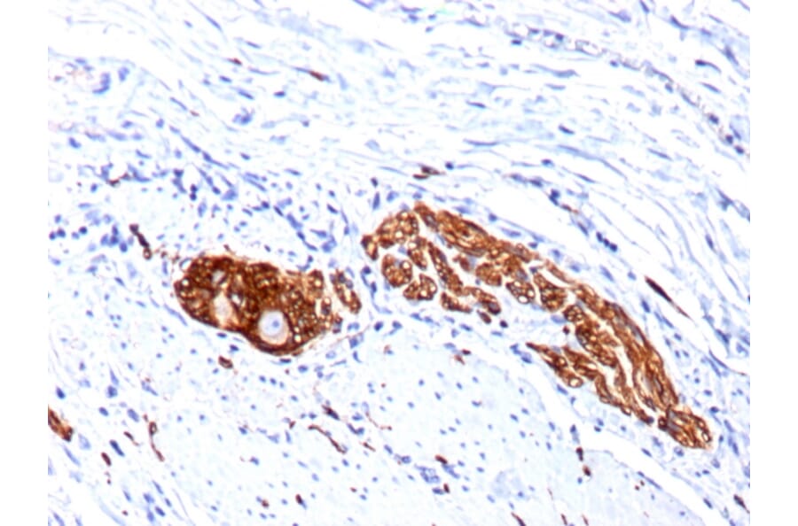 Immunohistochemistry - Anti-NCAM1 Antibody [123C3.D5 + 123A8] (A249477) - Antibodies.com