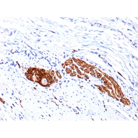 Immunohistochemistry - Anti-NCAM1 Antibody [123C3.D5 + 123A8] (A249477) - Antibodies.com