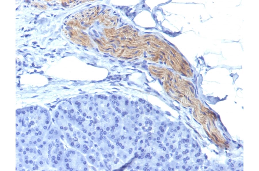 Immunohistochemistry - Anti-NCAM1 Antibody [NCAM1/795] (A249480) - Antibodies.com