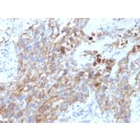 Immunohistochemistry - Anti-NCAM1 Antibody [NCAM1/795] (A249479) - Antibodies.com