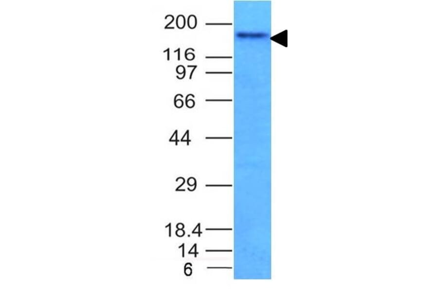 Western Blot - Anti-NCAM1 Antibody [NCAM1/795] (A249480) - Antibodies.com