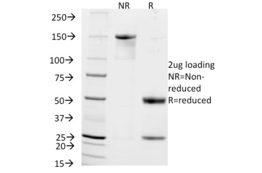 SDS-PAGE - Anti-NCAM1 Antibody [NCAM1/795] (A249480) - Antibodies.com