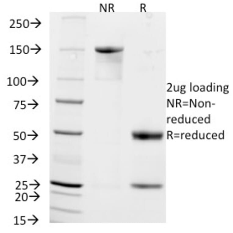 SDS-PAGE - Anti-NCAM1 Antibody [NCAM1/795] (A249480) - Antibodies.com