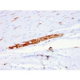 Immunohistochemistry - Anti-NCAM1 Antibody [ERIC-1] (A249481) - Antibodies.com