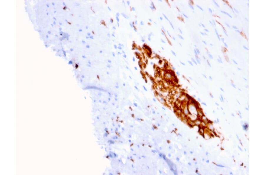 Immunohistochemistry - Anti-NCAM1 Antibody [ERIC-1] (A249480) - Antibodies.com