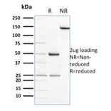 SDS-PAGE - Anti-NCAM1 Antibody [ERIC-1] (A249481) - Antibodies.com