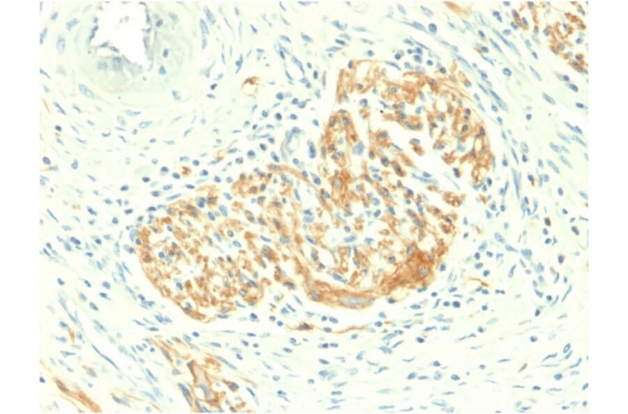 Immunohistochemistry - Anti-NCAM1 Antibody [NCAM1/2217R] (A249481) - Antibodies.com