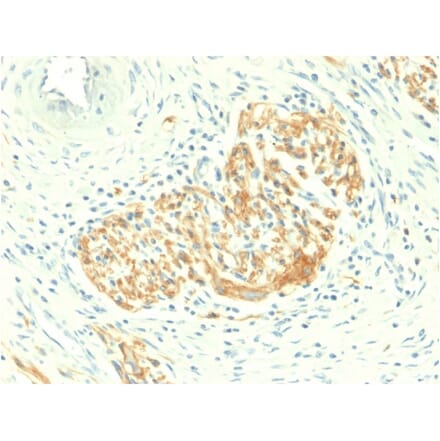 Immunohistochemistry - Anti-NCAM1 Antibody [NCAM1/2217R] (A252642) - Antibodies.com