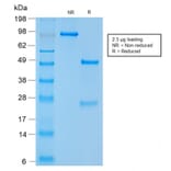 SDS-PAGE - Anti-NCAM1 Antibody [NCAM1/2217R] (A249482) - Antibodies.com