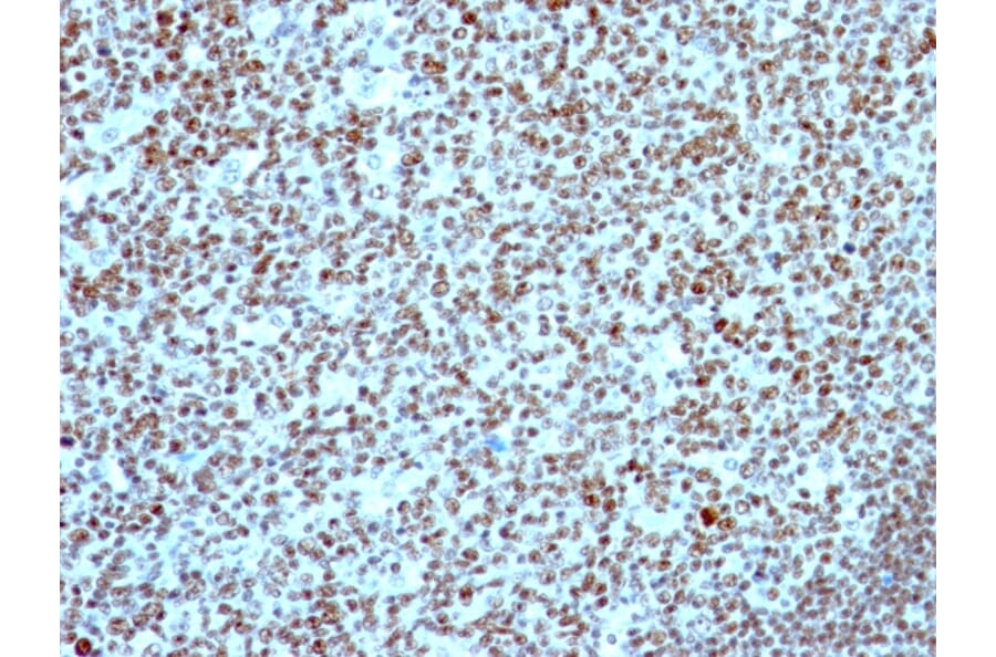 Immunohistochemistry - Anti-Nucleolin Antibody [NCL/902] (A249483) - Antibodies.com