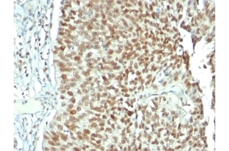 Immunohistochemistry - Anti-Nucleolin Antibody [NCL/902] (A249483) - Antibodies.com