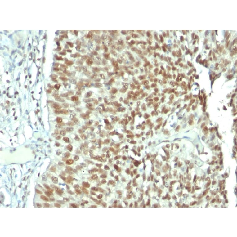 Immunohistochemistry - Anti-Nucleolin Antibody [NCL/902] (A249483) - Antibodies.com