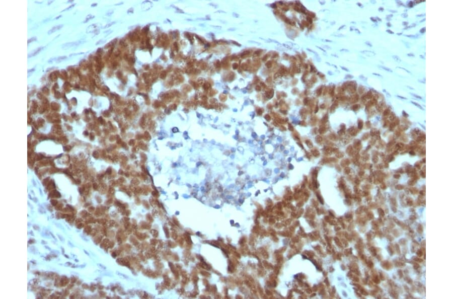 Immunohistochemistry - Anti-Nucleolin Antibody [NCL/902] (A249483) - Antibodies.com