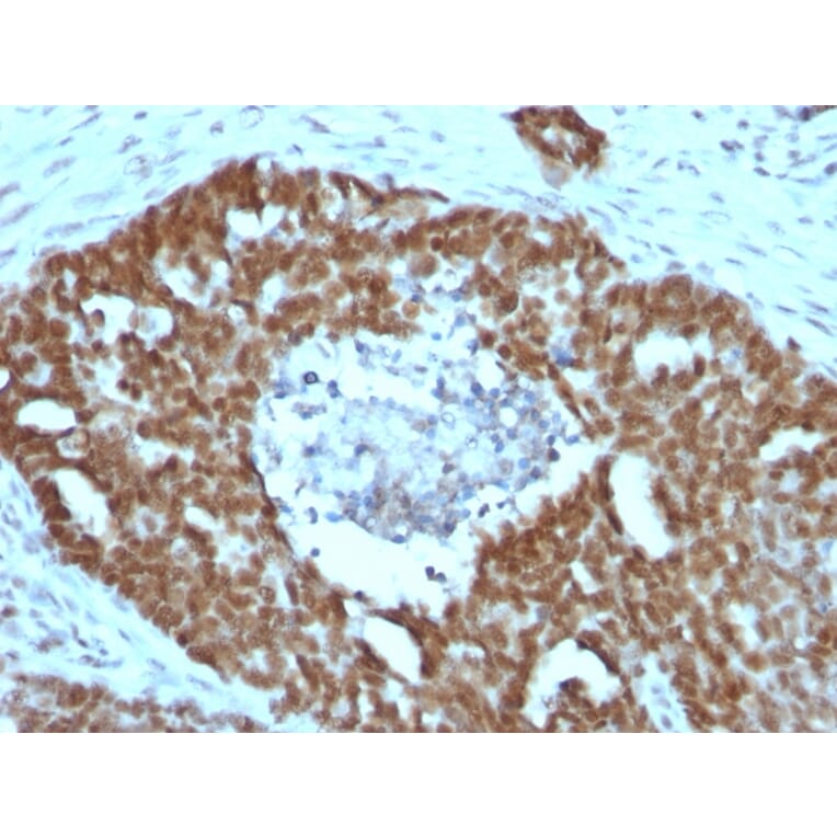 Immunohistochemistry - Anti-Nucleolin Antibody [NCL/902] (A249483) - Antibodies.com