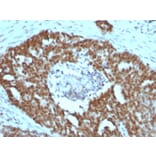 Immunohistochemistry - Anti-Nucleolin Antibody [NCL/902] (A249483) - Antibodies.com