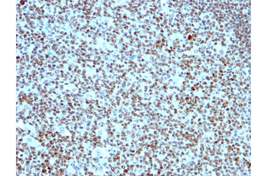 Immunohistochemistry - Anti-Nucleolin Antibody [SPM614] (A249484) - Antibodies.com