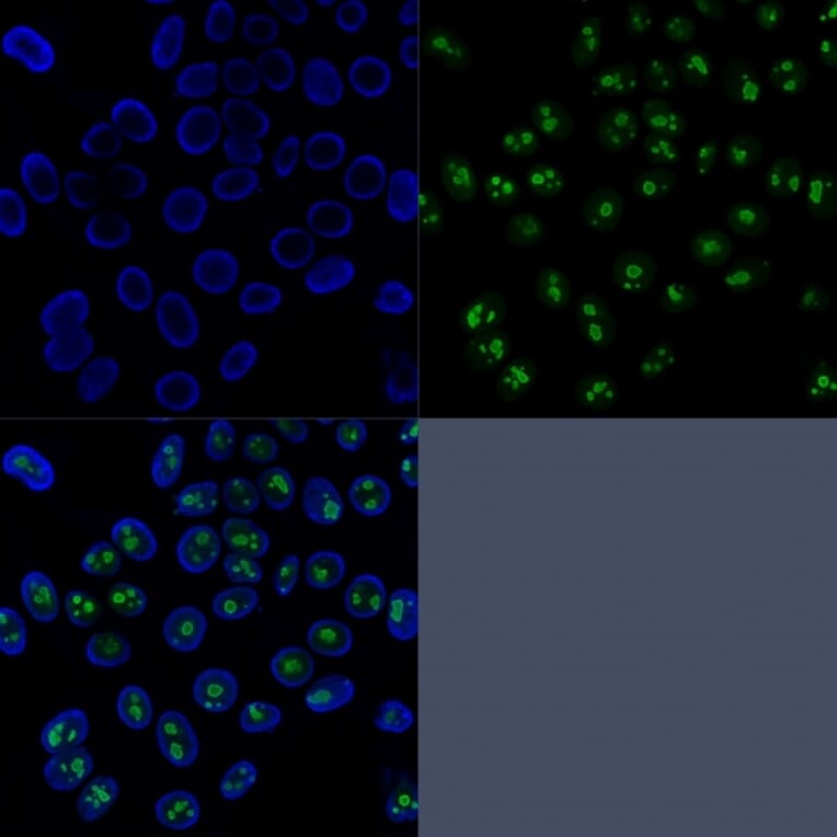 Immunofluorescence - Anti-Nucleolin Antibody [SPM614] (A249484) - Antibodies.com