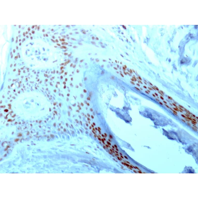 Immunohistochemistry - Anti-Nucleolin Antibody [364-5] (A249485) - Antibodies.com