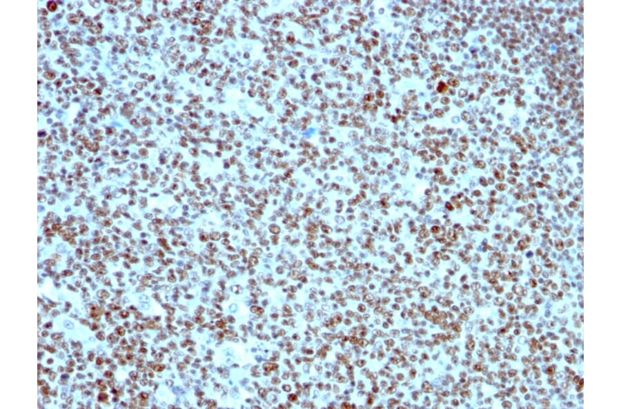 Immunohistochemistry - Anti-Nucleolin Antibody [364-5] (A249485) - Antibodies.com
