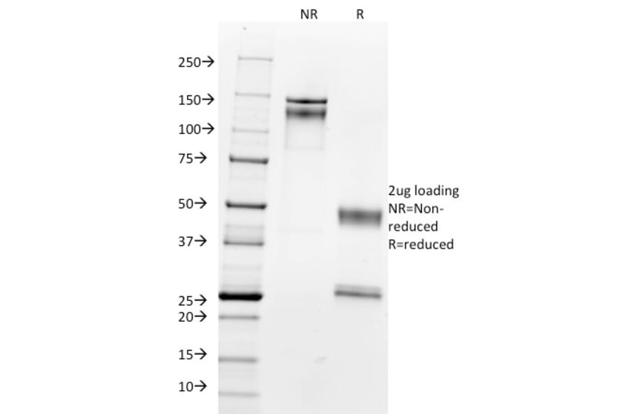 SDS-PAGE - Anti-Nucleolin Antibody [364-5] (A249485) - Antibodies.com