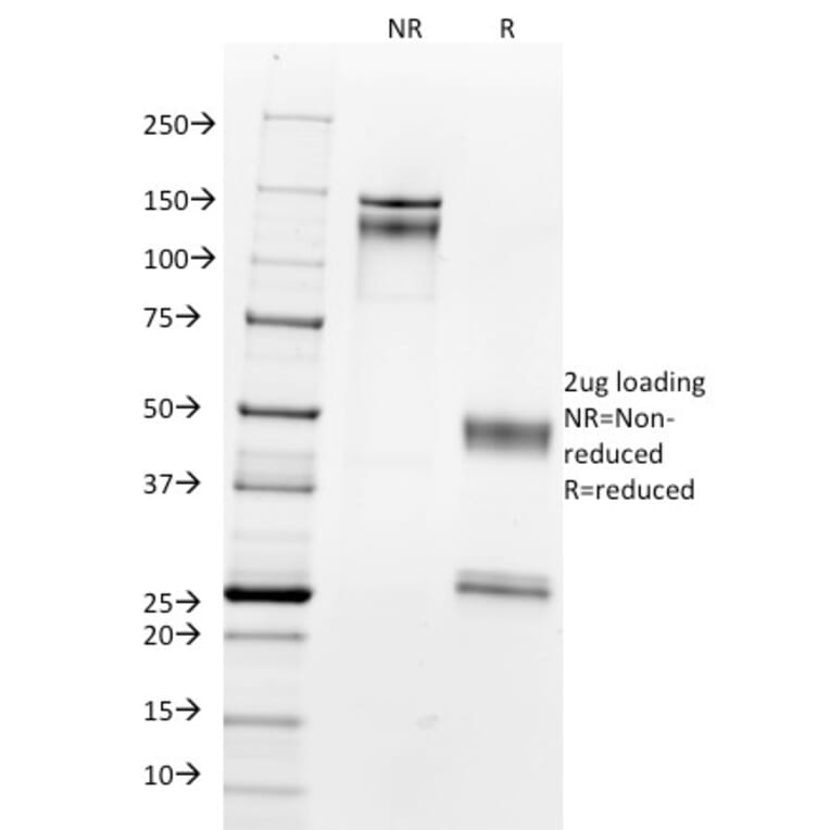 SDS-PAGE - Anti-Nucleolin Antibody [364-5] (A249485) - Antibodies.com