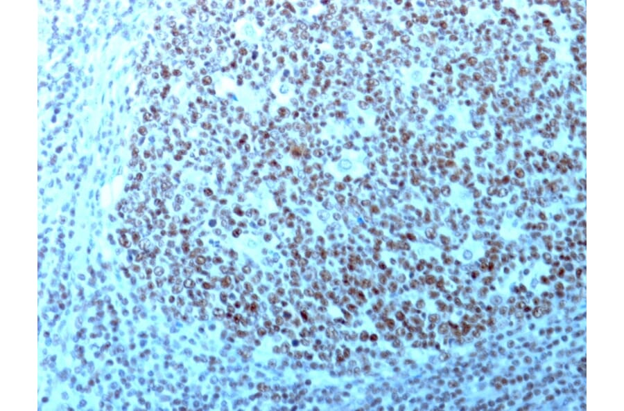 Immunohistochemistry - Anti-Nucleolin Antibody [364-5 + NCL/902] (A249486) - Antibodies.com