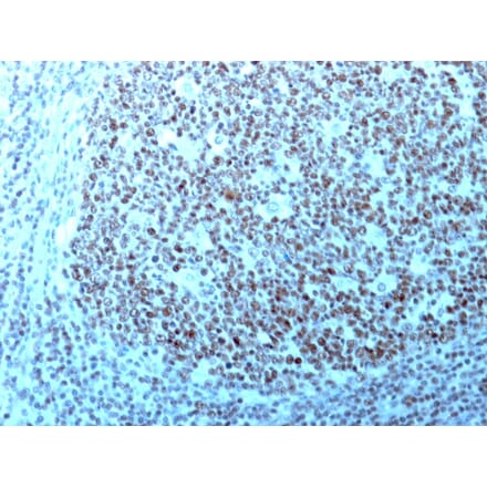 Immunohistochemistry - Anti-Nucleolin Antibody [364-5 + NCL/902] (A249486) - Antibodies.com