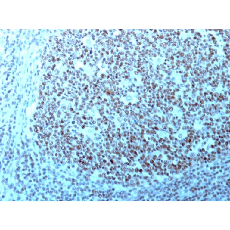 Immunohistochemistry - Anti-Nucleolin Antibody [364-5 + NCL/902] (A249486) - Antibodies.com