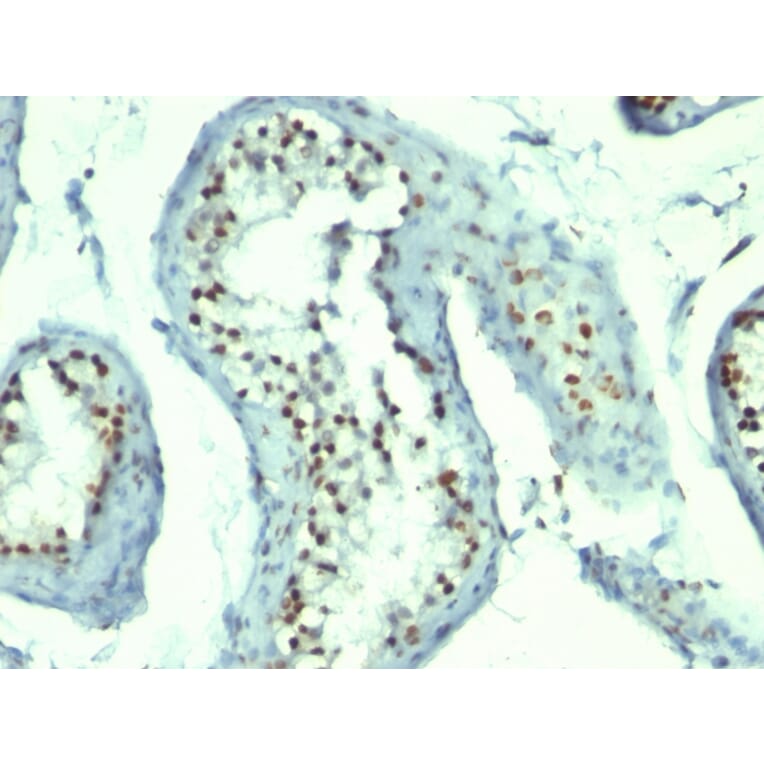Immunohistochemistry - Anti-Nucleolin Antibody [364-5 + NCL/902] (A249486) - Antibodies.com