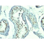 Immunohistochemistry - Anti-Nucleolin Antibody [364-5 + NCL/902] (A249486) - Antibodies.com