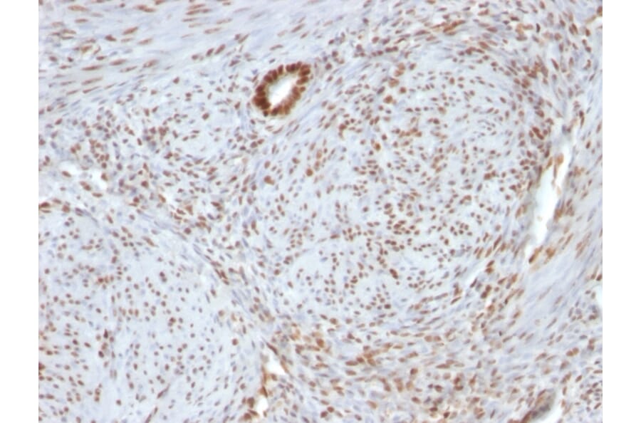 Immunohistochemistry - Anti-Nucleolin Antibody [364-5 + NCL/902] (A249486) - Antibodies.com