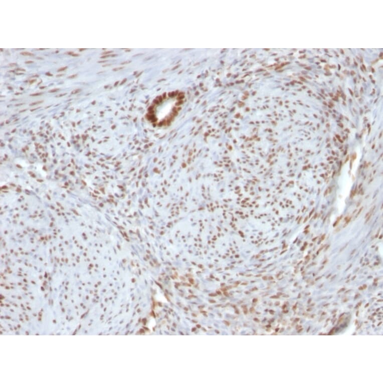 Immunohistochemistry - Anti-Nucleolin Antibody [364-5 + NCL/902] (A249486) - Antibodies.com