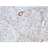 Immunohistochemistry - Anti-Nucleolin Antibody [364-5 + NCL/902] (A249486) - Antibodies.com