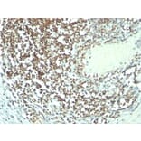 Immunohistochemistry - Anti-Nucleolin Antibody [364-5 + NCL/902] (A249486) - Antibodies.com