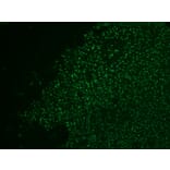 Immunohistochemistry - Anti-Nucleolin Antibody [364-5 + NCL/902] (A249486) - Antibodies.com