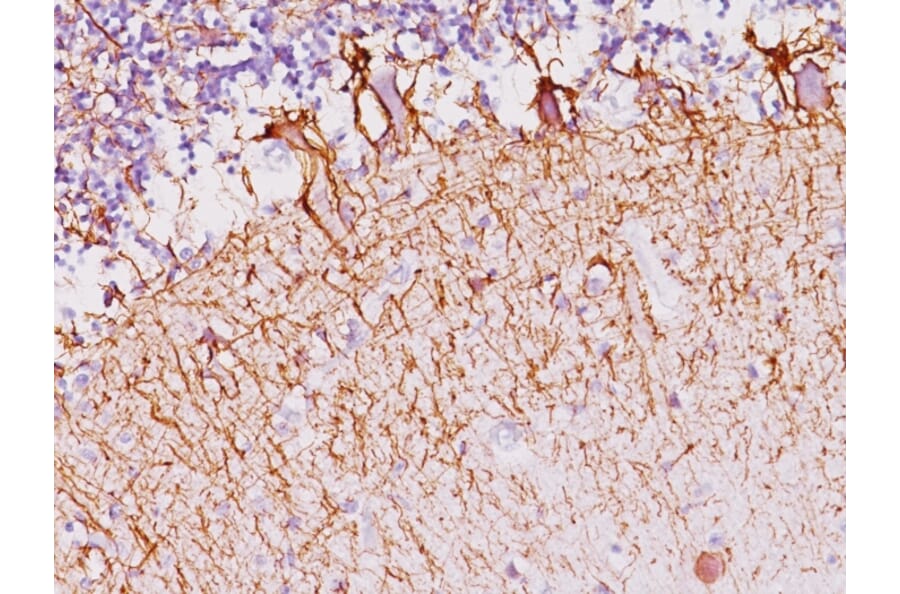 Immunohistochemistry - Anti-Neurofilament Heavy Polypeptide Antibody [NF421] (A249487) - Antibodies.com