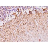 Immunohistochemistry - Anti-Neurofilament Heavy Polypeptide Antibody [NF421] (A249487) - Antibodies.com