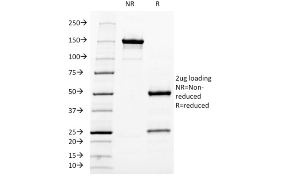 SDS-PAGE - Anti-Neurofilament Heavy Polypeptide Antibody [NF421] (A249487) - Antibodies.com
