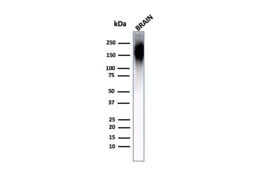 Western Blot - Anti-Neurofilament Heavy Polypeptide Antibody [NF421] (A249487) - Antibodies.com