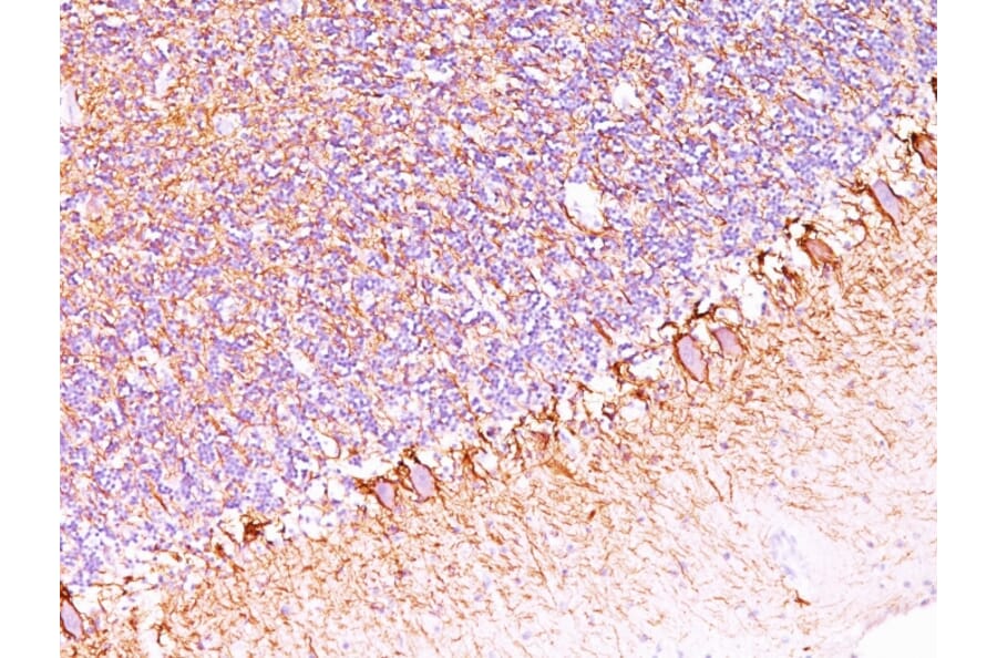 Immunohistochemistry - Anti-Neurofilament Heavy Polypeptide Antibody [SPM563] (A249487) - Antibodies.com