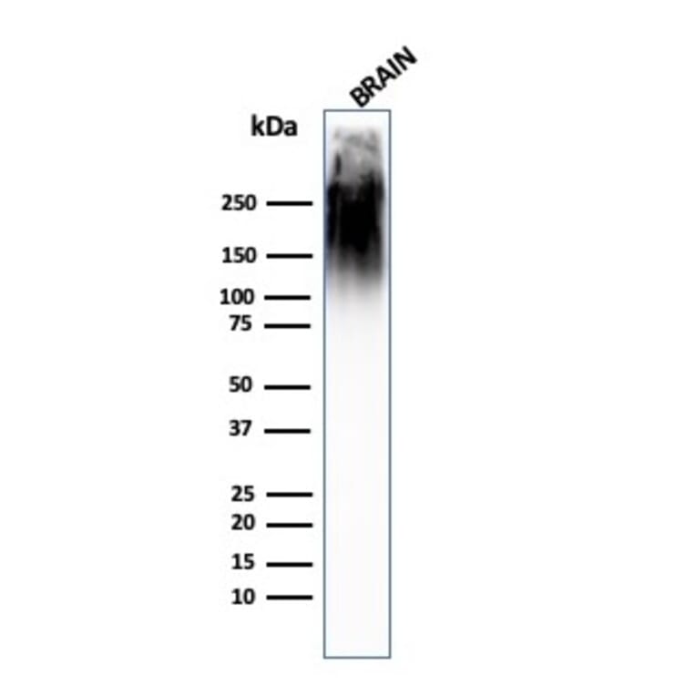 Western Blot - Anti-Neurofilament Heavy Polypeptide Antibody [SPM563] (A249488) - Antibodies.com