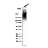 Western Blot - Anti-Neurofilament Heavy Polypeptide Antibody [SPM563] (A249488) - Antibodies.com