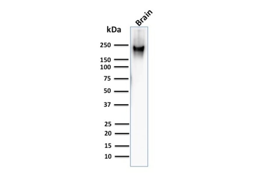 Western Blot - Anti-Neurofilament Heavy Polypeptide Antibody [RT97] (A249489) - Antibodies.com