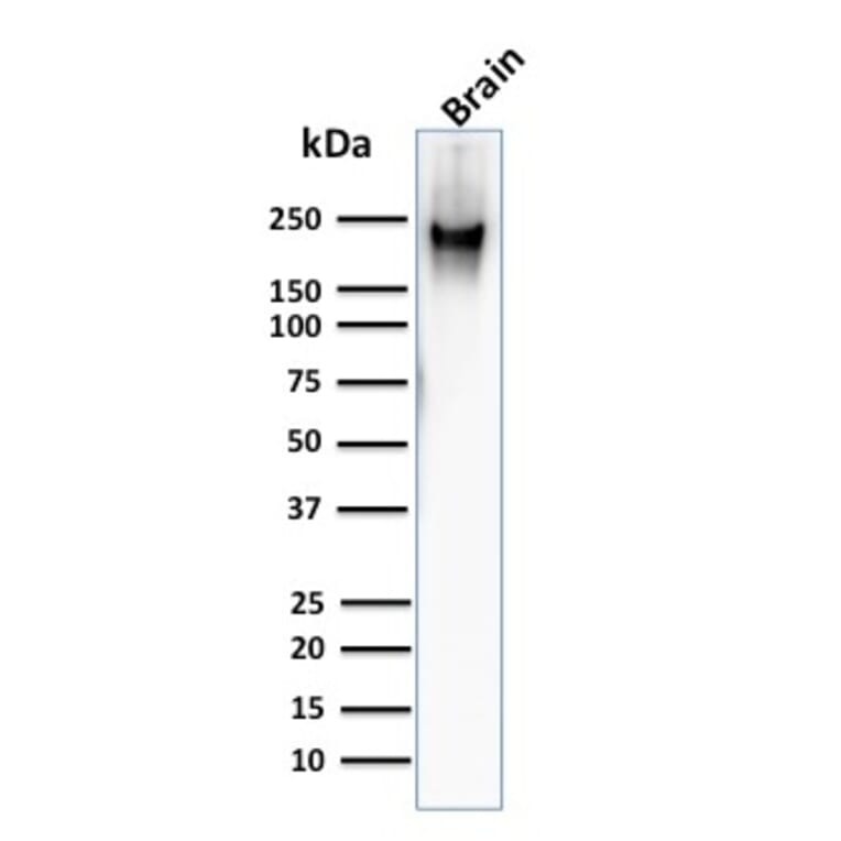 Western Blot - Anti-Neurofilament Heavy Polypeptide Antibody [RT97] (A249489) - Antibodies.com