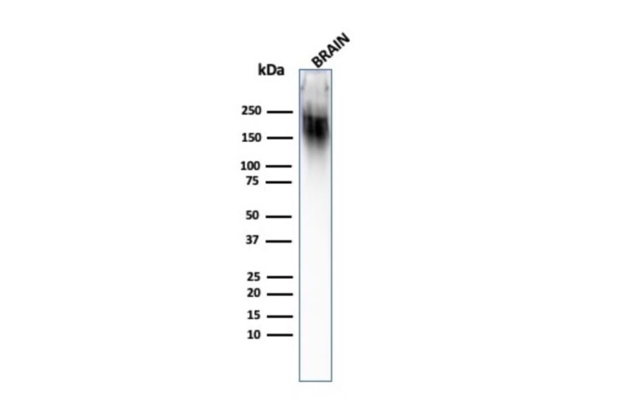 Western Blot - Anti-Neurofilament Heavy Polypeptide Antibody [SPM203] (A249490) - Antibodies.com