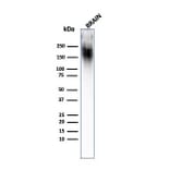 Western Blot - Anti-Neurofilament Heavy Polypeptide Antibody [SPM203] (A249490) - Antibodies.com